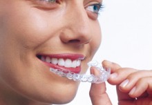 Invisalign Carabanchel